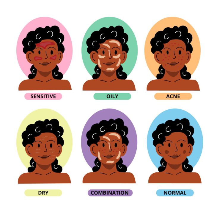 representative drawing of the different types of skin
