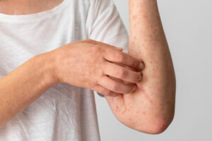maladie de la peau que faire ?