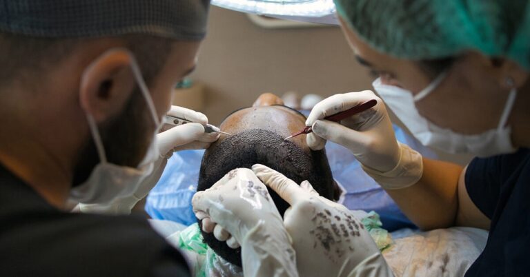 tricopigmentation on a patient