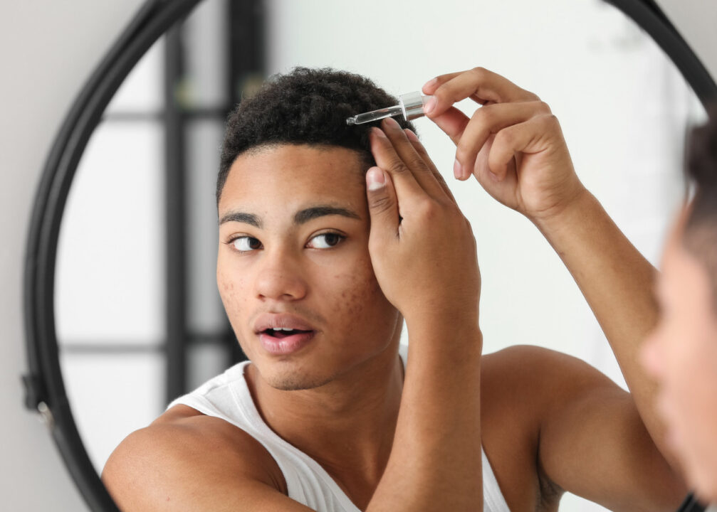 Soro capilar: Homem aplicando soro em seu cabelo