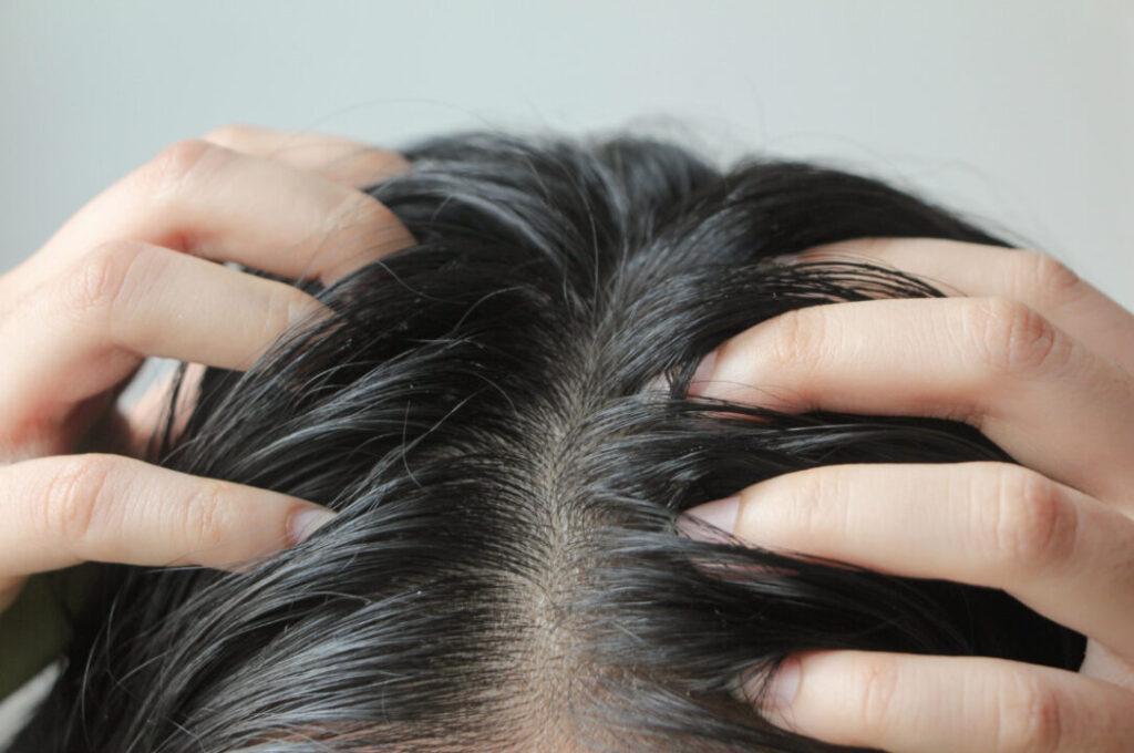 Soro capilar: close-up do couro cabeludo sensível